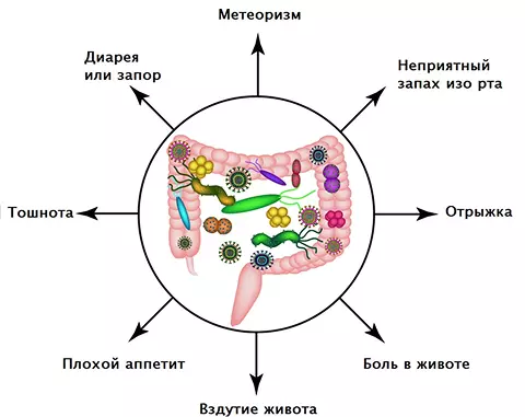 Лечение дисбактериоза в г. Иркутск
