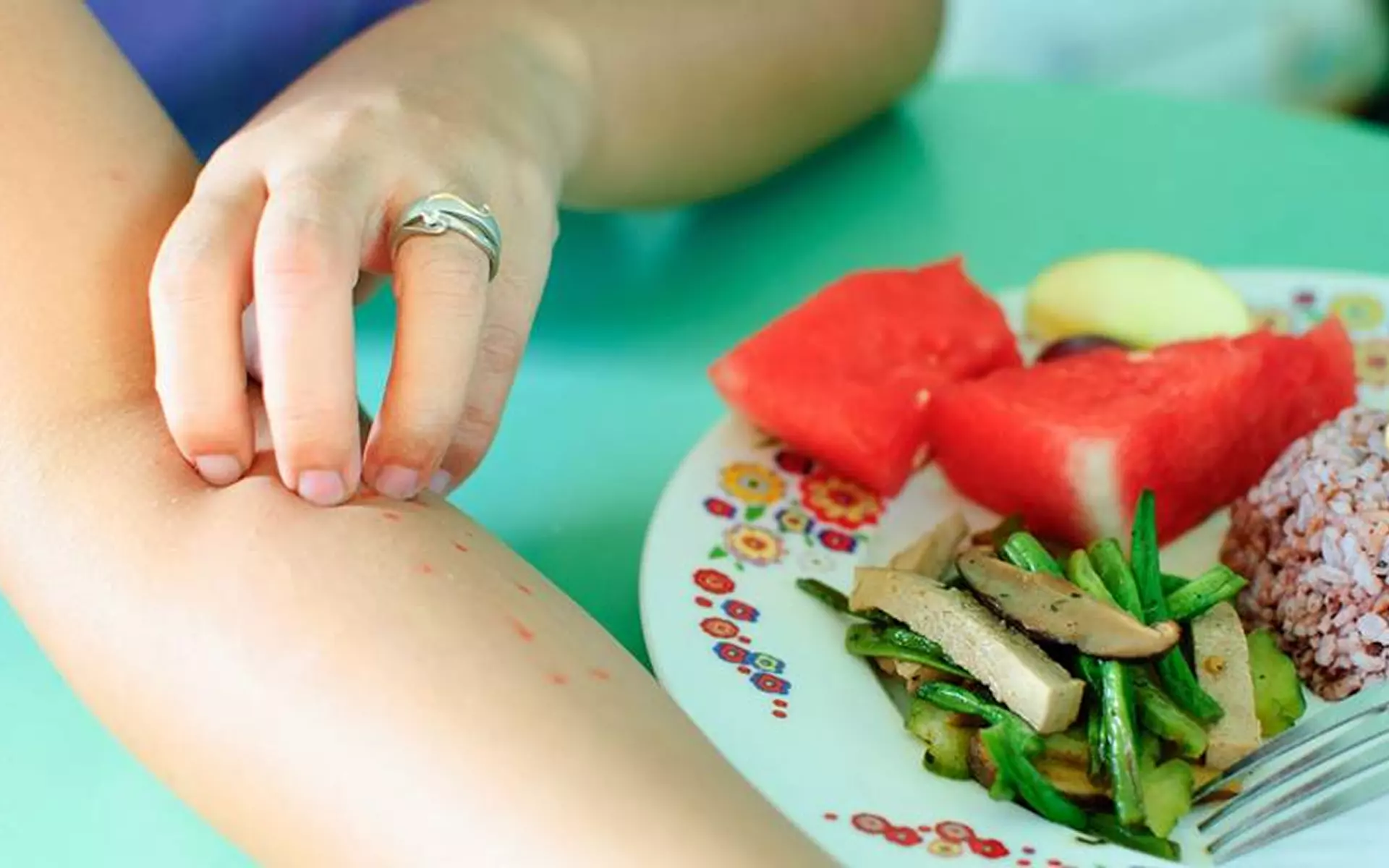 Лечение аллергии на продукты в г. Иркутск